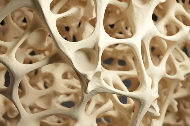 عوامل جينية تساهم في هشاشة العظام