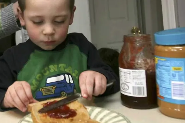 يعاني 5 في المائة من الأطفال من حساسية الطعام (أ.ب)