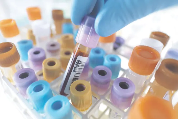 أفكار جديدة حول اختبارات الدم المهمة