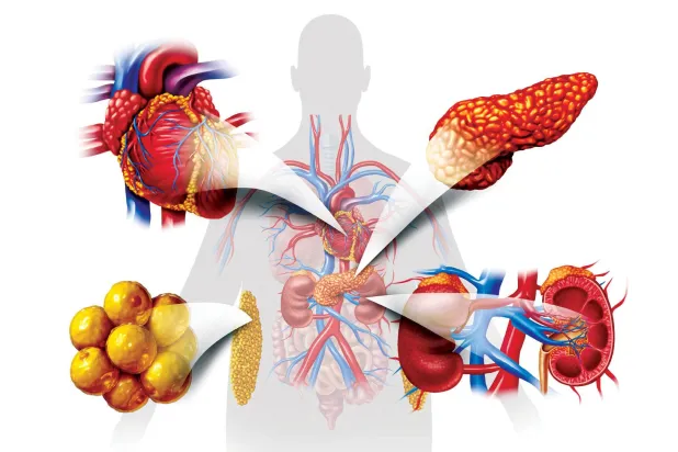 تعزيز استراتيجيات إدارة اضطرابات الدهون في الدم