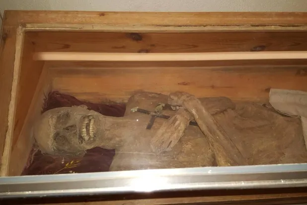 مومياء قس نمساوي توفي عام 1746 (جامعة لودفيغ ماكسيميليان)