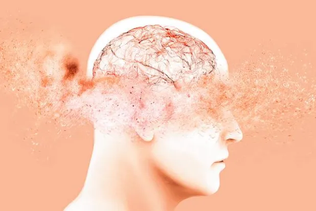 يتأثر أكثر من 6 ملايين أميركي بألزهايمر (فاندربيلت)