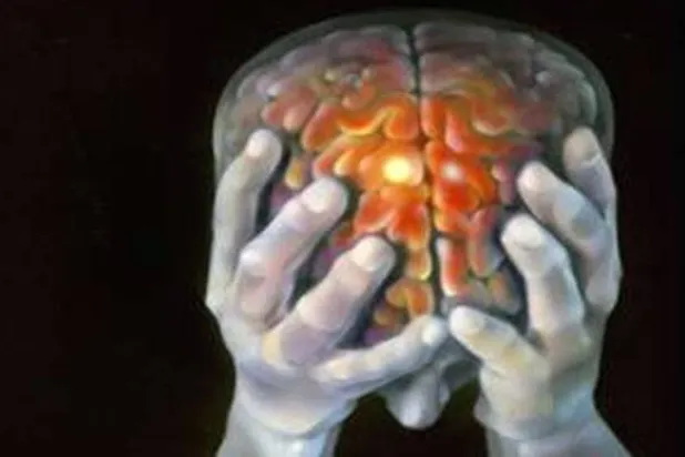 تعدّ السكتة الدماغية ثالث سبب رئيسي للوفاة في جميع أنحاء العالم (رويترز)