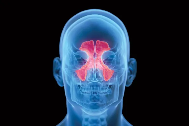 الجيوب الأنفية... 8 معلومات حول سلامتها