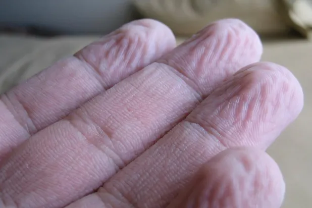 Parmakların suda kalınca buruşmasının nedeni damarların sıkışması (Binghamton Üniversitesi)