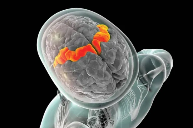 ساعدت الأقطاب المزروعة في هذه المنطقة على تسجيل نشاط الدماغ (ساينس فوتز)
