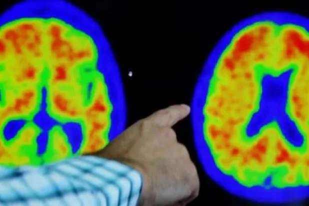 الدوبامين مادة كيميائية ننتجها في دماغنا (أرشيفية-رويترز)