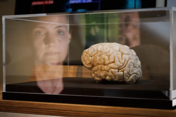 التقنية الجددة تُظهر دقة عالية في فك تشفير الإشارات من أدمغة المرضى وترجمتها إلى كلام مكتوب أو حركات آلية (د.ب.أ)