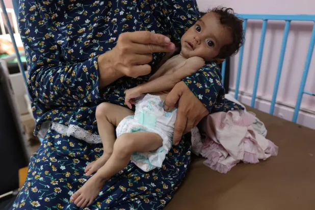 امرأة فلسطينية من قطاع غزة تحتضن طفلتها البالغة 5 أشهر التي تعاني من سوء التغذية (رويترز)