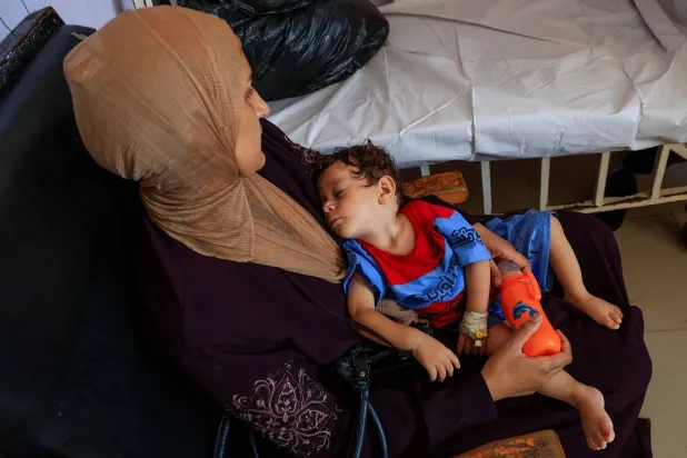 صحة غزة: ارتفاع ضحايا الجوع وسوء التغذية إلى 159 وفاة