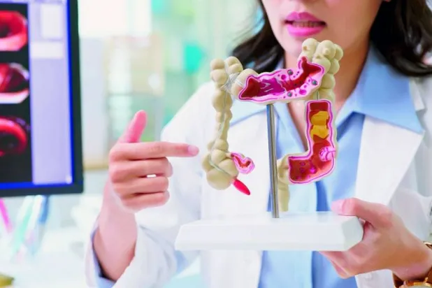 زراعة الكبد... بارقة أمل جديدة لمرضى سرطان القولون والمستقيم