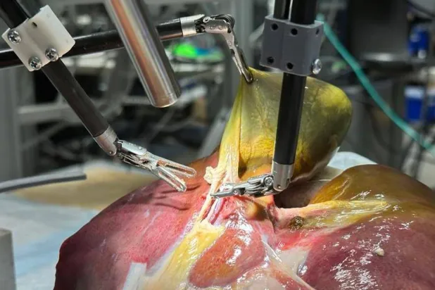  Cerrahi Robot Transformatör-Hiyerarşisi'nin videolarla eğitilerek gerçekçi bir hasta üzerinde safra kesesinin alınması gibi uzun bir işlemi gerçekleştirdiğini duyurdu (Juo-Tung Chen/Johns Hopkins Üniversitesi)