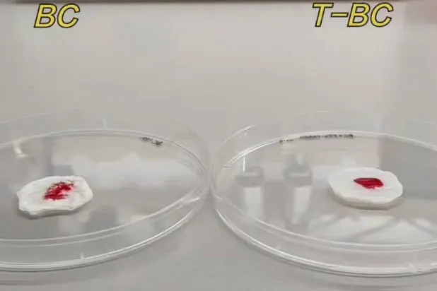 الضمادة الجديدة قادرة على تحقيق وقف فوري للنزيف خلال دقيقة واحدة فقط (دورية أدفانسد ماتيريالز)