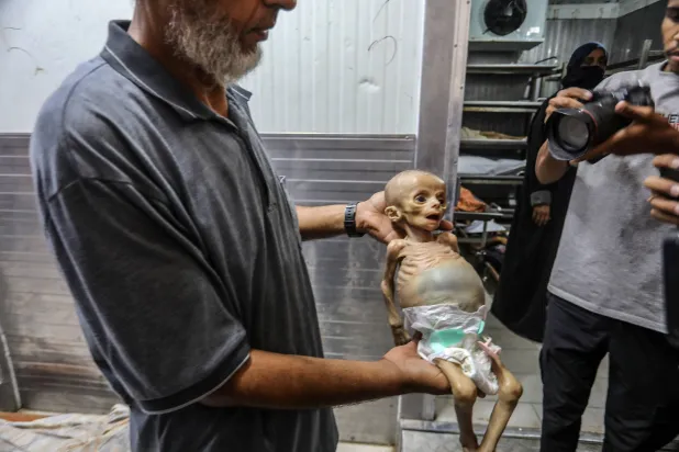 بالقصف والتجويع... «يونيسف»: 28 طفلاً يُقتلون في غزة يومياً