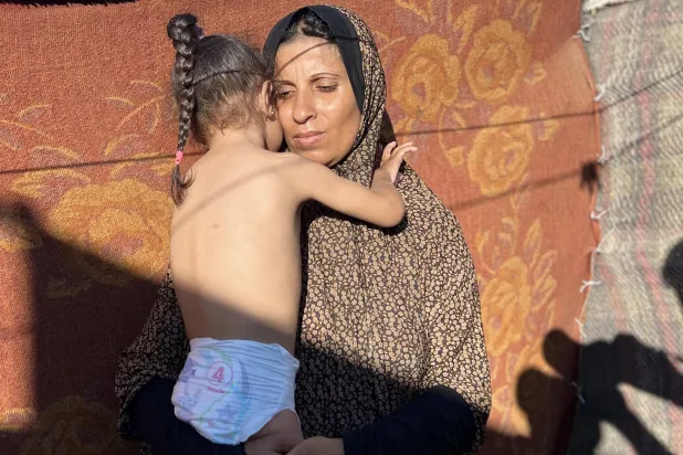 صحة غزة: ارتفاع ضحايا التجويع في قطاع غزة إلى 197 وفاة