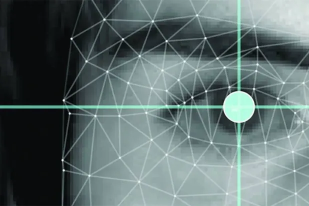 هل توصلنا أخيراً لطريقة لقياس طنين الأذن؟