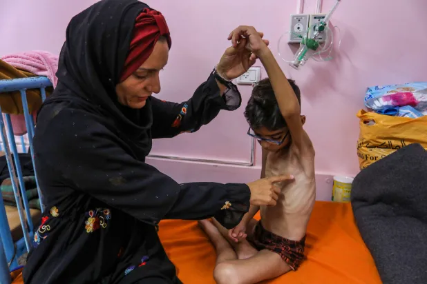 فلسطينية تمسك ابنها المصاب بسوء تغذية حاد في مستشفى بغزة الجمعة (د.ب.أ)