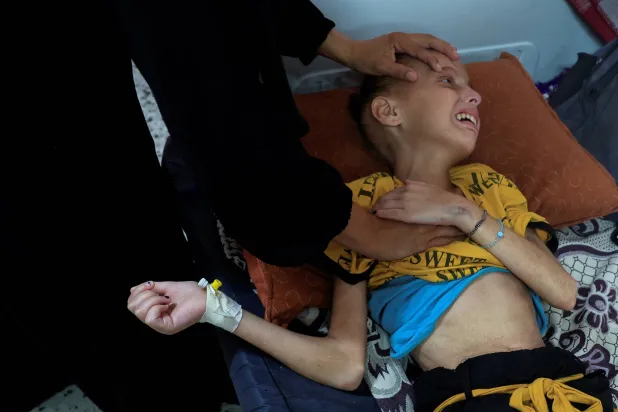 الطفلة الفلسطينية هدى أبو النجا تتلقى الرعاية الصحية في مستشفى الناصر بخان يونس بقطاع غزة (رويترز)