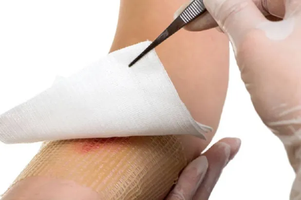 خلايا الجسم تُغير شكلها لإصلاح الجروح بسرعة (جامعة هدرسفيلد)