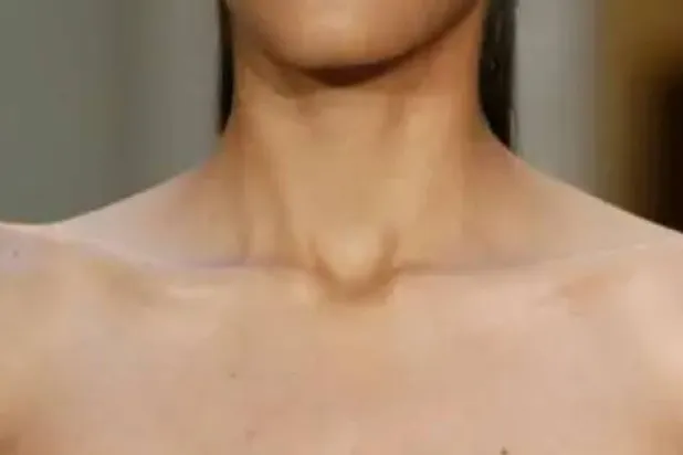 حجم رقبة الشخص يمكن أن يكون مؤشراً على صحته (رويترز)