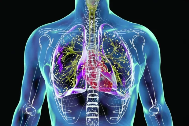 خريطة طريق نحو «مستقبل بلا سُلّ»
