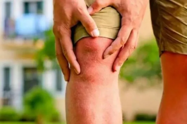 المشكلات الهيكلية في الركبتين أصبحت شائعة بحلول سن الثلاثين (رويترز)