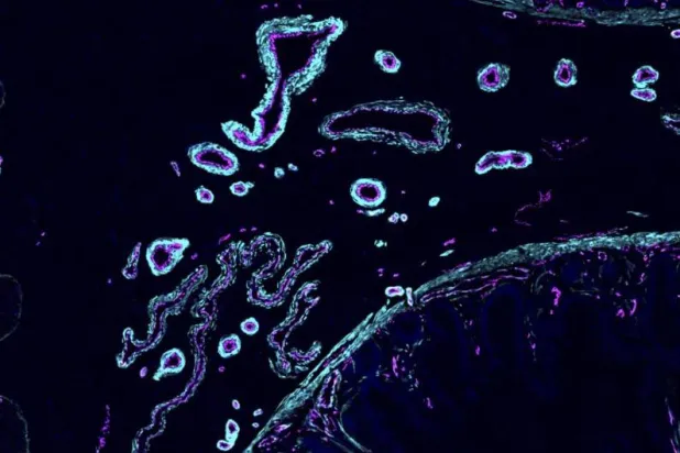 خلايا الجسم المصابة يُمكنها «تقيؤ» محتوياتها للتمكن من الشفاء سريعاً (أ.ب)