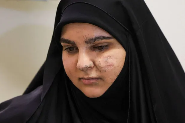 زينب مستراح (27 عاماً) من مصابي تفجيرات البيجر... بيروت 15 سبتمبر 2025 (رويترز)