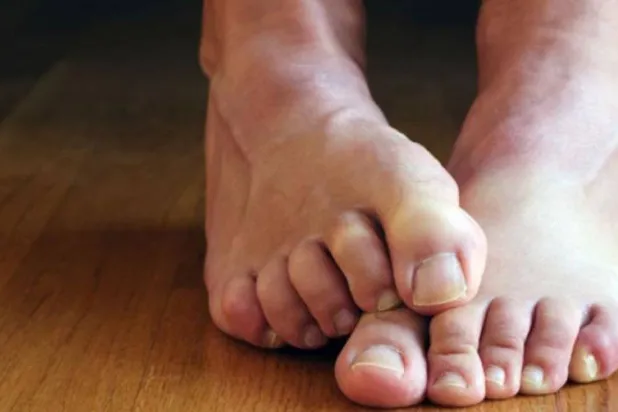قد تشير التغيرات التي تحدث بالقدم إلى إصابتك بأمراض خطيرة (رويترز)
