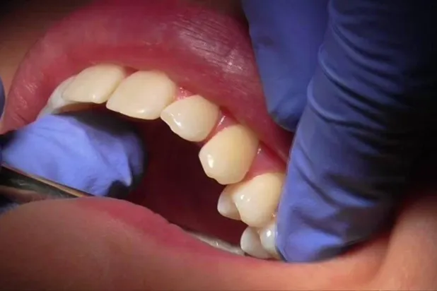 الأنظمة الغذائية تؤثر على صحة الفم والأسنان (رويترز)