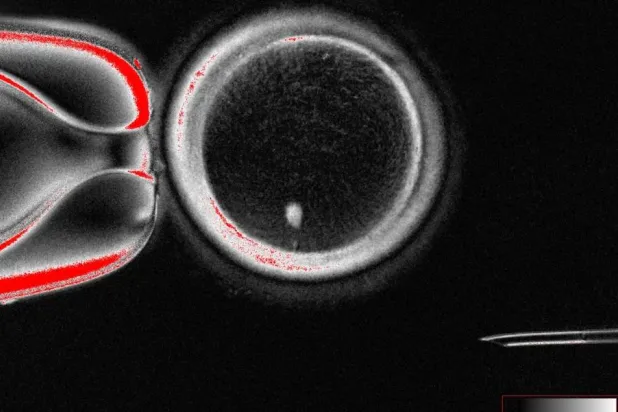 بويضة بشرية وظيفية - النقطة المضيئة هي النواة المنقولة لخلية جلدية (مختبر «ميتاليبوف»)