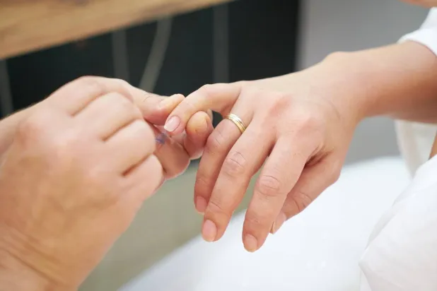 «أظافر قشر البيض»... ما هي؟ وما أبرز أسبابها؟