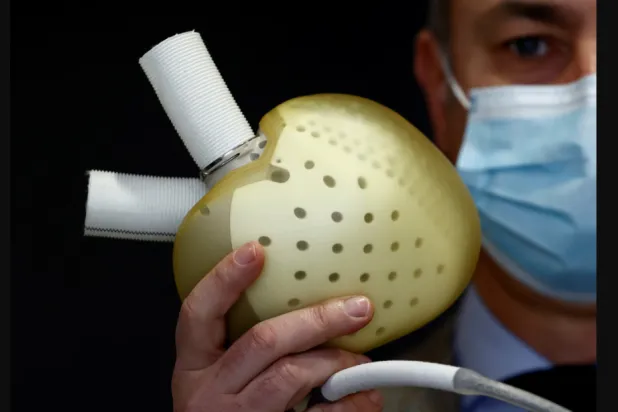 الدوار والتعرق البارد أو الغثيان المفاجئ من الأعراض الجسدية للنوبة القلبية (رويترز)