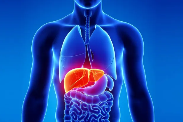 مرض التهاب الكبد الدهني المرتبط بخلل التمثيل الغذائي يعد أحد أكثر أمراض الكبد المزمنة شيوعاً (جامعة كونيتيكت)