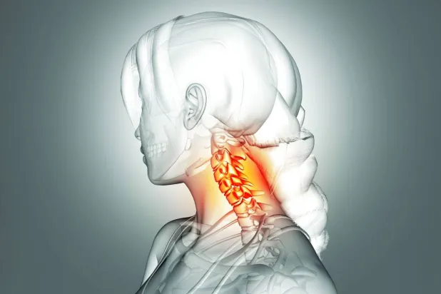 7 أسباب لآلام الرقبة