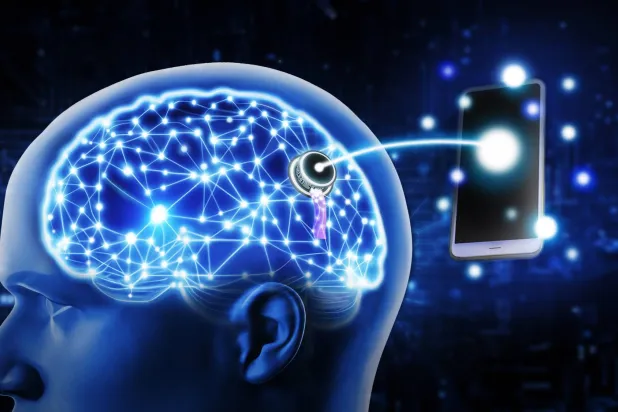 إنجازات رائدة في زراعة غرسات الدماغ