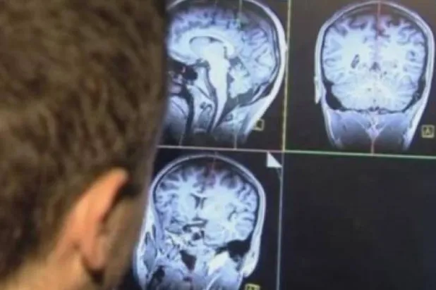 يُعد سرطان الرأس والرقبة سادس أكثر أشكال السرطان شيوعاً في العالم (أرشيفية - رويترز)