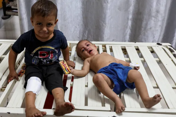 أطفال فلسطينيون يتلقون العلاج بعد إصابتهم في غارة إسرائيلية بمستشفى ناصر في خان يونس جنوب القطاع (رويترز)