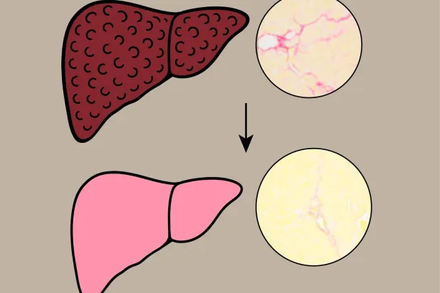 مركب طبيعي في الحناء قد يُصلح أنسجة الكبد التالفة (جامعة أوساكا متروبوليتان)