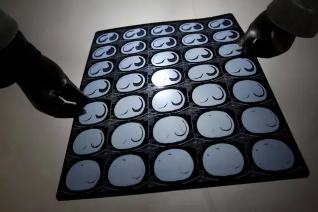 صور أشعة مقطعية للأمعاء (أرشيفية - رويترز)