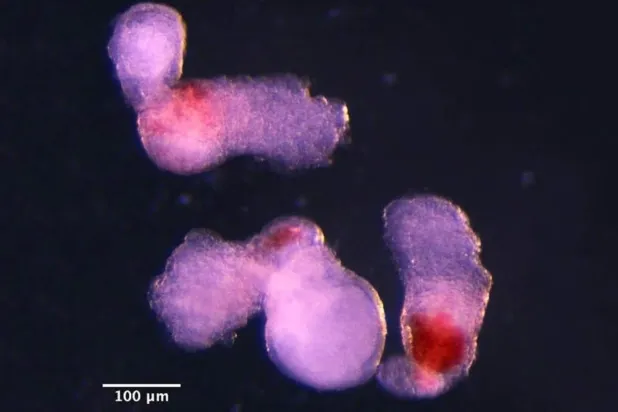 Cambridge Üniversitesi'ndeki bilim insanları embriyo benzeri yapılara "hematoid" adını verdi (Jitesh Neupane/Cambridge Üniversitesi)