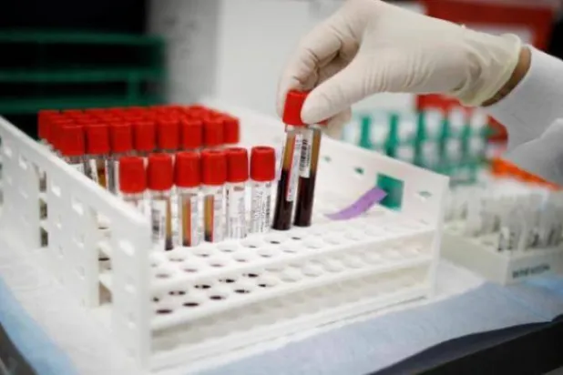 الاختبار يعتمد على تحليل مستويات المواد الحيوية في الدم (رويترز)