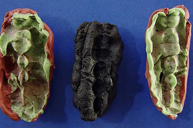 قوالب أسنان تعود إلى عصور ما قبل التاريخ (أ.ف.ب)