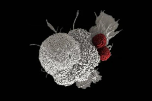 EBV konak hücre çekirdeği içinde etkileşime giriyor (ABD Ulusal Sağlık Enstitüleri)