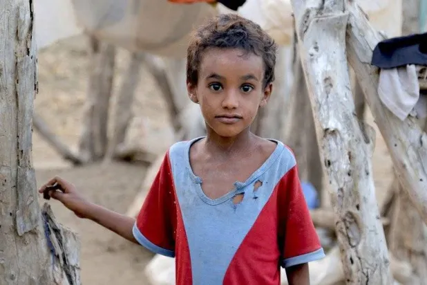 ملايين الأطفال اليمنيين يواجهون خطر سوء التغذية ونقص الخدمات الصحية (الأمم المتحدة)