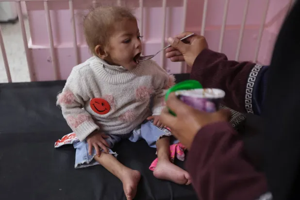 الطفلة الغزية أرجوان المصابة بسوء تغذية حاد تتلقى الطعام من أمها في مستشفى الناصر بخان يونس  أمس (رويترز)