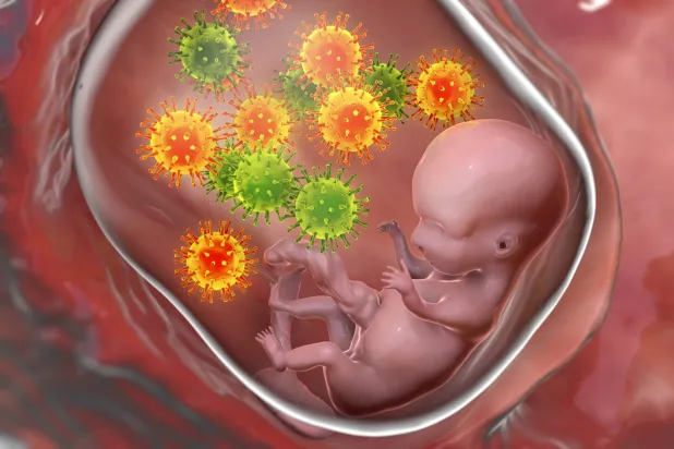 شكل تصويري لانتقال الفيروس المضخم للخلايا عبر المشيمة
