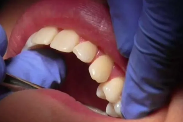 حالة الأسنان قد تتنبأ باحتمالية الوفاة المبكرة (رويترز)