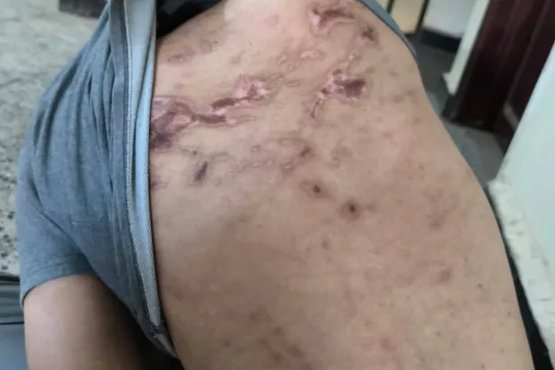 «الشرق الأوسط» تكشف تفاصيل ممارسات القوات الإماراتية بحق سجناء مطار الريان 