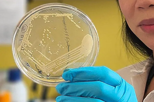 Çalışmanın başyazarı Cynthia Hsu, bir hastanın dışkı örneğini inceliyor (UC San Diego Sağlık Bilimleri)